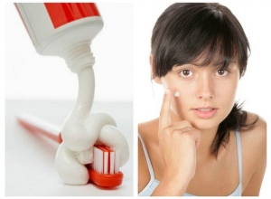 Độc chiêu trị tàn nhang bằng kem đánh răng siêu đơn giản và hiệu quả trong vòng 1 tháng